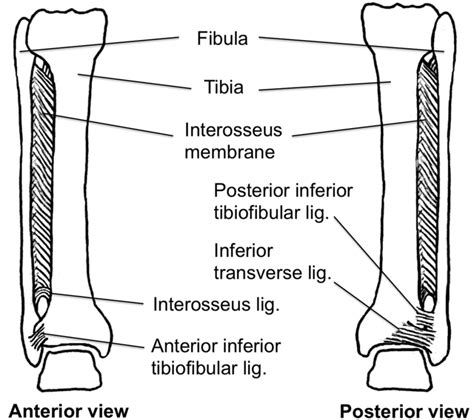 syndesmosis leg